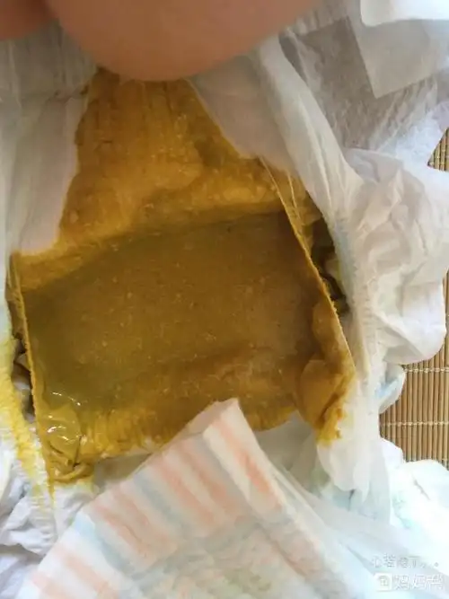 少食高脂,高糖,高油的食物,多吃新鲜蔬菜水果,粗粮类食品.3.