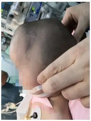 你知道吗?宝宝头形异常,不是睡偏头那么简单