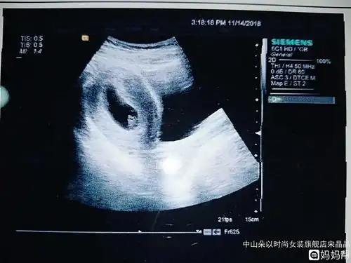 18.9*9.3孕囊能看出男女吗"福如东海"-第1张图片-酷虎博客