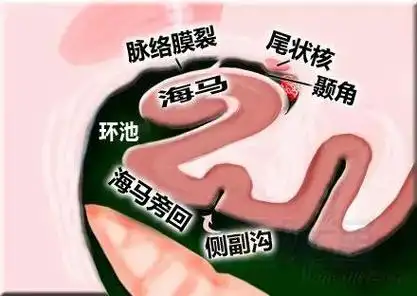 大脑横裂断层解剖图(简明易懂的脑部断层解剖图谱)(21)
