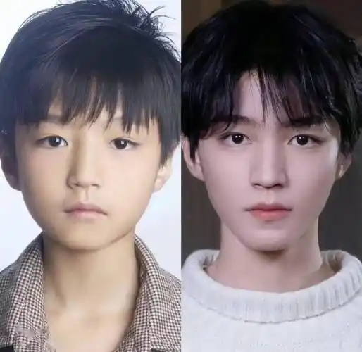 考古王俊凯小时候和女生合照,还发现他的脸上有两条小疤痕_下巴_眼神