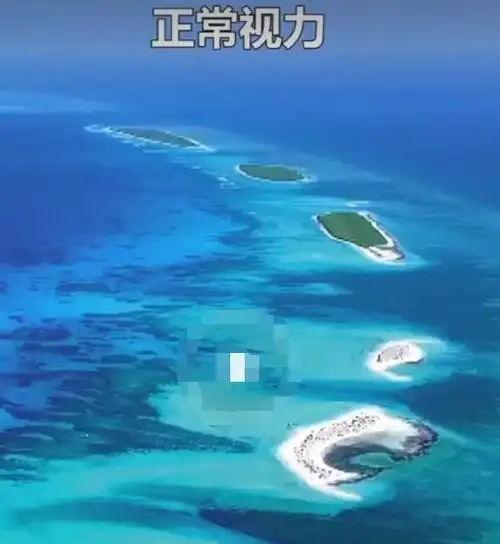 近视100度和200度左右时