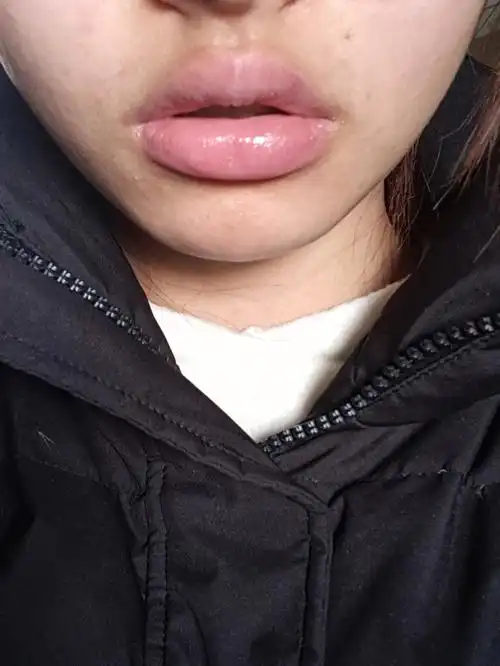 这种嘴属于什么情况啊