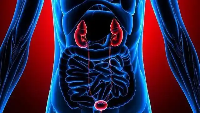 肾结石这个病是怎样形成的