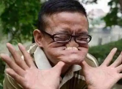 搞笑的吉尼斯世界之最82岁老人为了破纪录让左手痛了66年