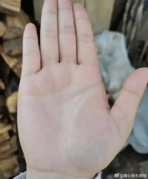 生命线末端三角纹手心有三角纹三角纹紧贴生命线图片掌纹女右手手相女