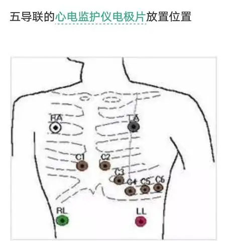 加强业务培训 提升应急能力——善卫儿科《心电监护仪的使用》