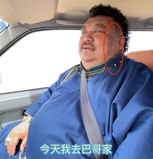 网红"恩克"状态堪忧,脸部黑斑明显,胖到呼吸困难仍大口吃牛肉