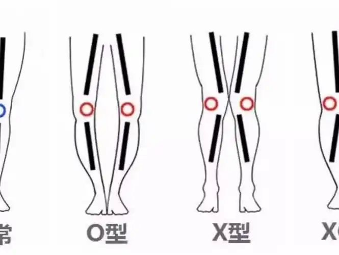 xo腿型改善计划