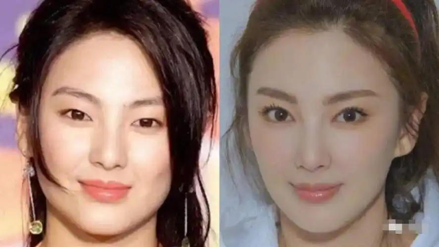 徐正曦双眼皮是割的吗徐正溪的眼睛属于什么眼