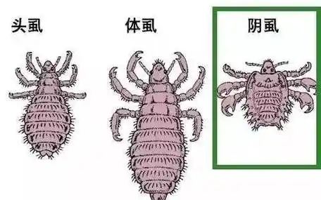 本文目录 1,长了阴虱怎么办 2,阴虱的临床症状 3,如何预防阴虱