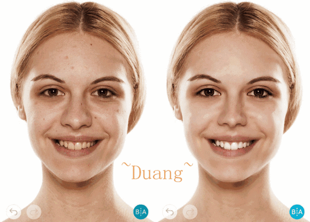 黄褐斑怎么快速去除2个祛斑小偏方最后一个方法每天坚持斑点消失