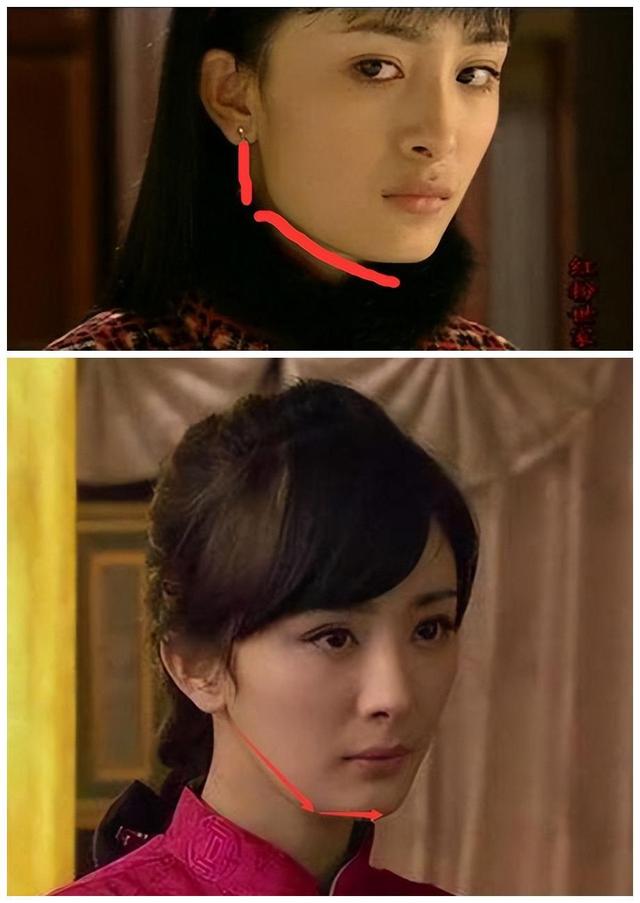 不知道什么时候开始,娱乐圈开始流行起了瓜子脸,这种审美也促使了"